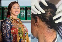 Former Dome-Kwabenya MP Sarah Adwoa Safo is receiving medical treatment after sustaining a gunshot injury during an incident at Kwabenya as police launch investigations into the circumstances surrounding the shooting.