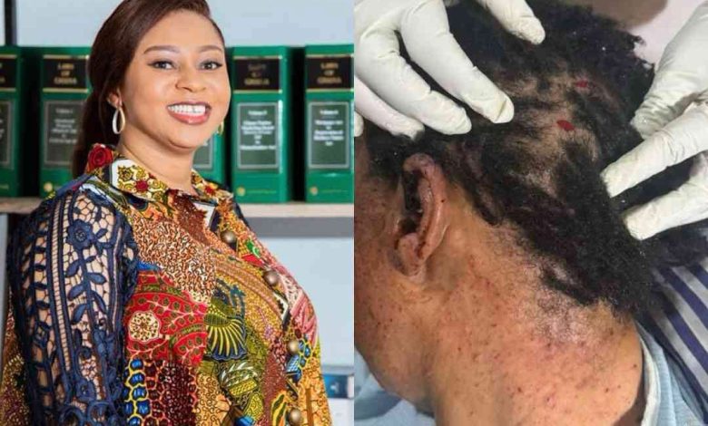 Former Dome-Kwabenya MP Sarah Adwoa Safo is receiving medical treatment after sustaining a gunshot injury during an incident at Kwabenya as police launch investigations into the circumstances surrounding the shooting.